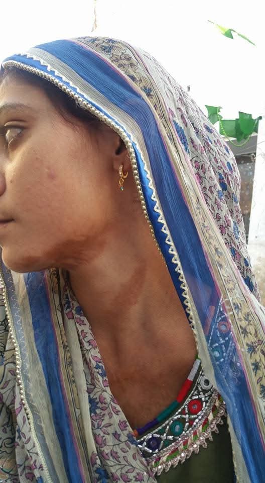 Samreen Kalji today, living with hope and dignity